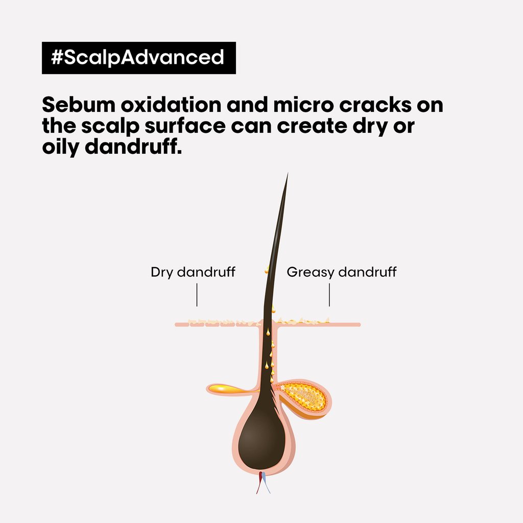 Anti-Discomfort Dermo-Regulator Shampoo - Image 3
